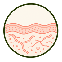 Collagen Loss