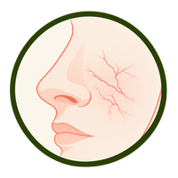 Visible Facial Vessels