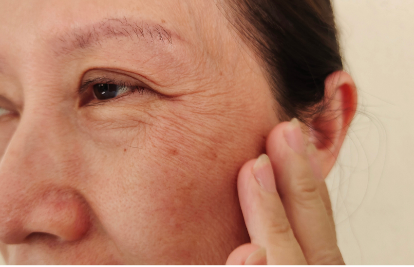 Woman with visible fine lines and wrinkles around the eyes and cheek