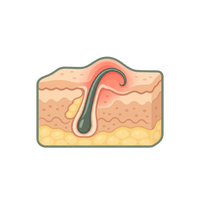 Inflammation