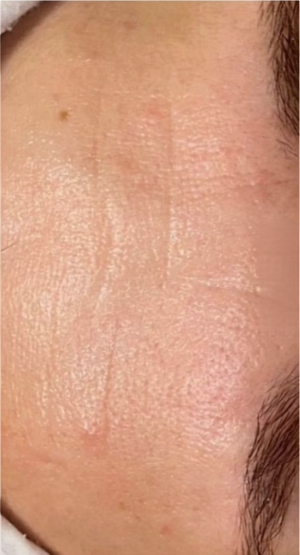 After treatment