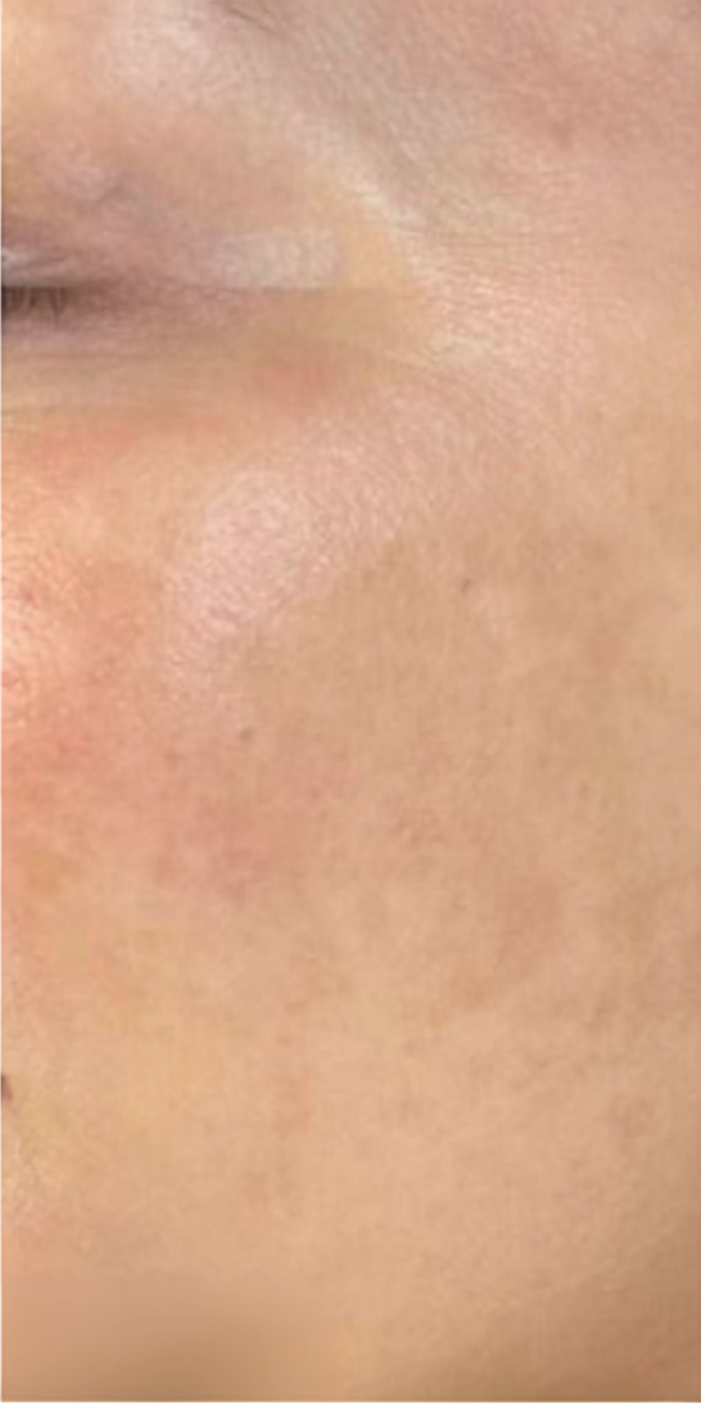 After treatment