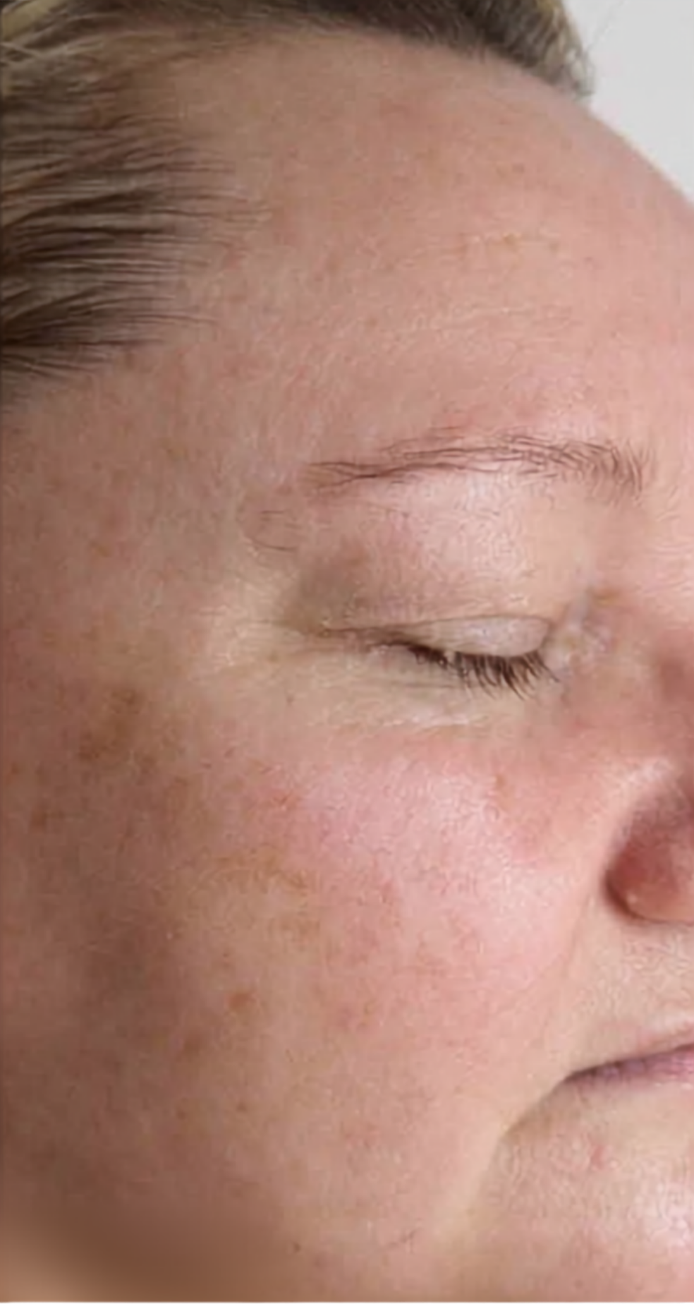 After treatment