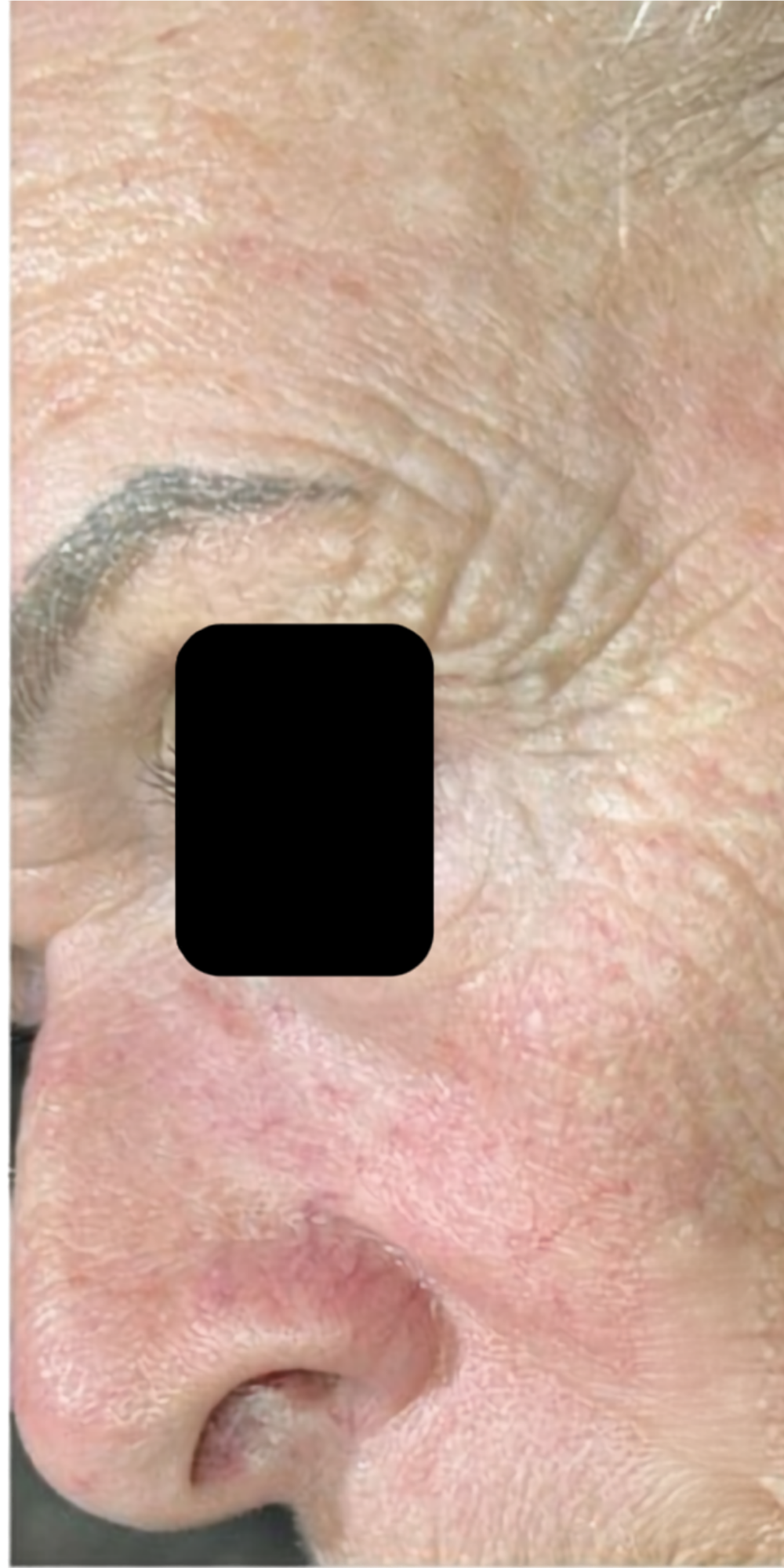 After treatment