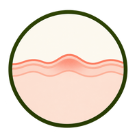 Inflammation