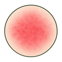Persistent Redness