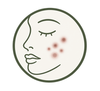 Post-Acne Marks
