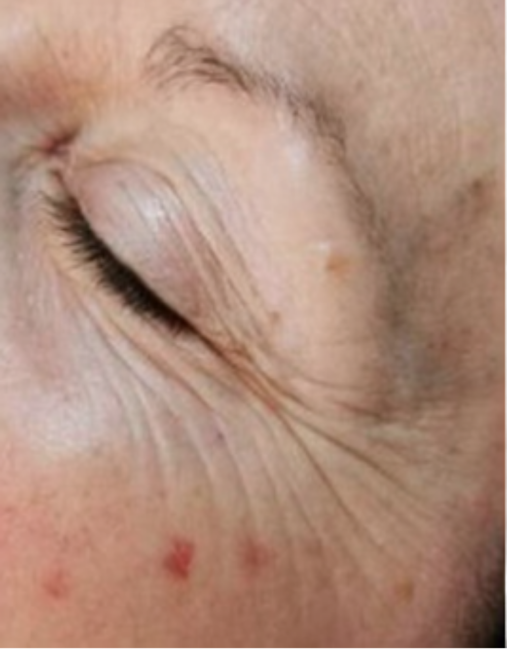 Before treatment