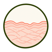 Collagen Loss & Damage