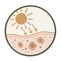 Sun Damage & Brown Spots