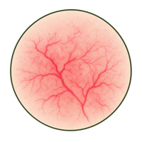 Visible Blood Vessels